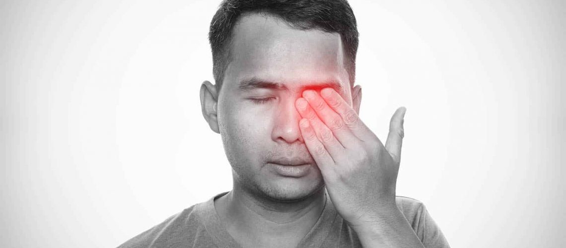 blefaroconjuntivitis fuengirola
